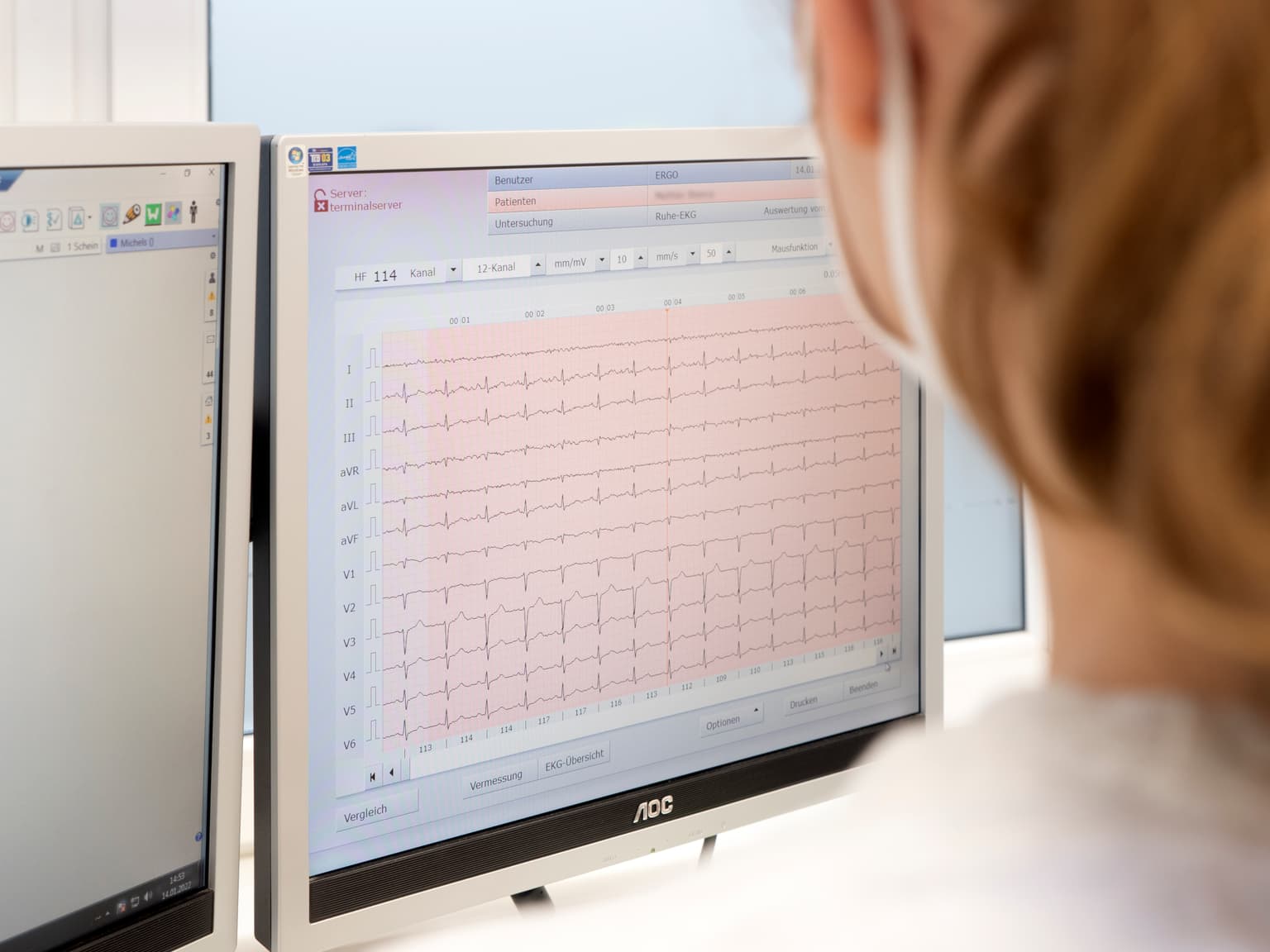 Nahaufnahme eines Computermonitors, auf dem ein EKG abgebildet ist.